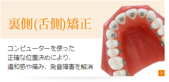 裏側(舌側)矯正