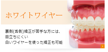 ホワイトワイヤー（表側矯正）