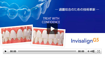 Invisalign G5