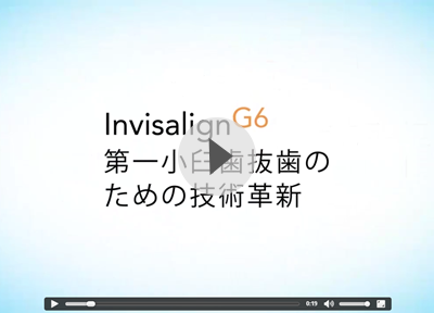 Invisalign G6