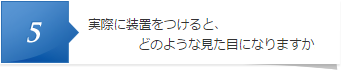 実際に装置をつけると、どのような見た目になりますか